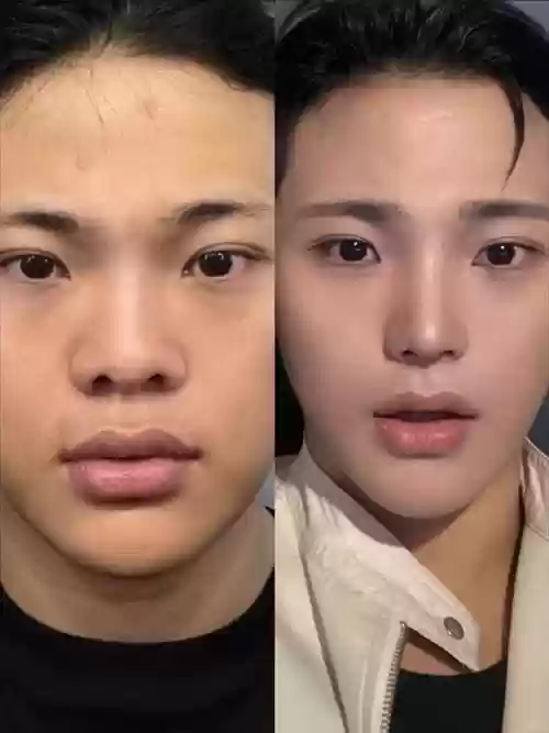 男生阵容鼻子插图1