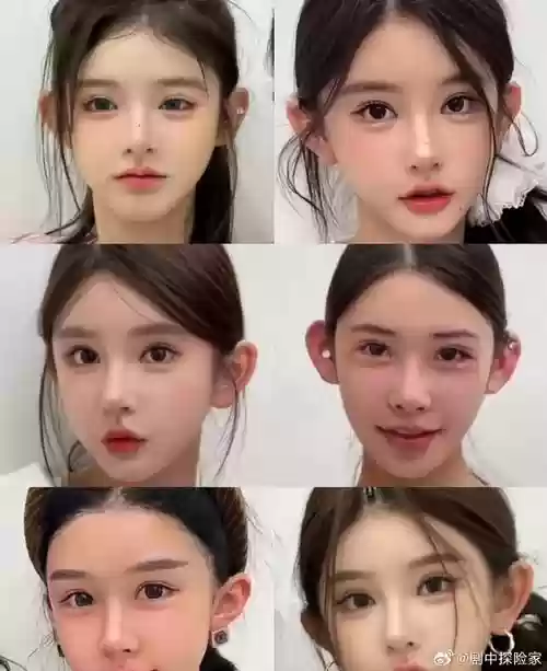 完美整容阵容插图1